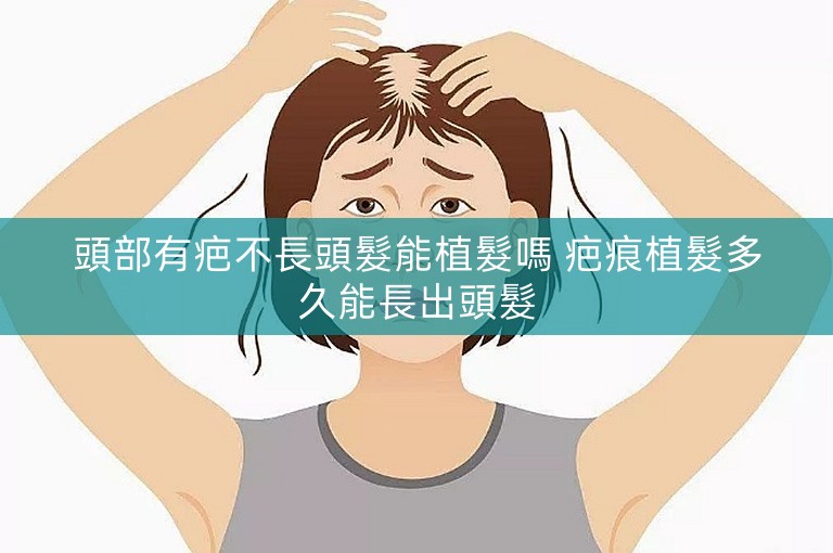 頭部有疤不長頭髮能植髮嗎 疤痕植髮多久能長出頭髮