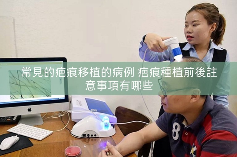 常見的疤痕移植的病例 疤痕種植前後註意事項有哪些 常見的疤痕移植的病例 疤痕種植前後註意事項有哪些