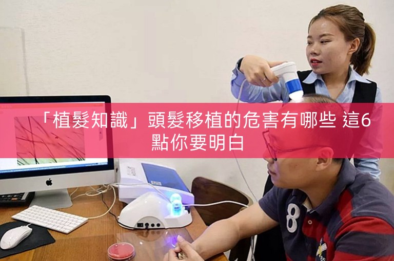 「植髮知識」頭髮移植的危害有哪些 這6點你要明白