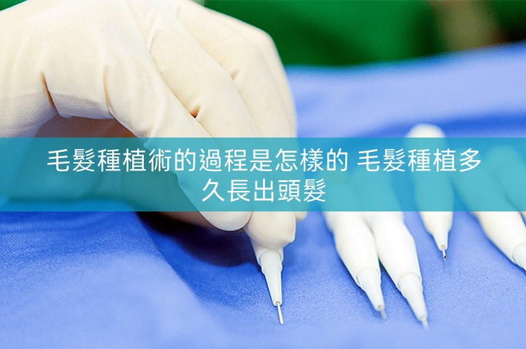 毛髮種植術的過程是怎樣的 毛髮種植多久長出頭髮 毛髮種植術的過程是怎樣的 毛髮種植多久長出頭髮
