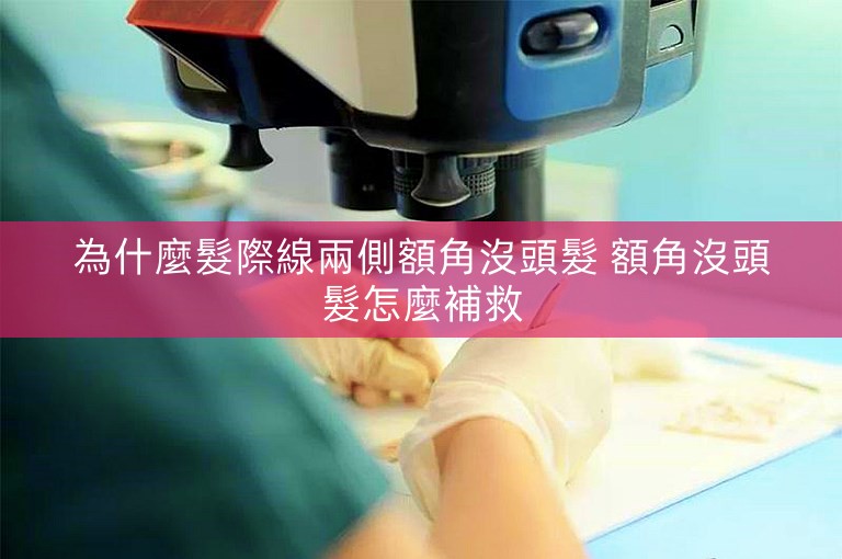 為什麼髮際線兩側額角沒頭髮 額角沒頭髮怎麼補救