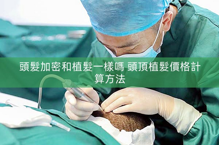 頭髮加密和植髮一樣嗎 頭頂植髮價格計算方法