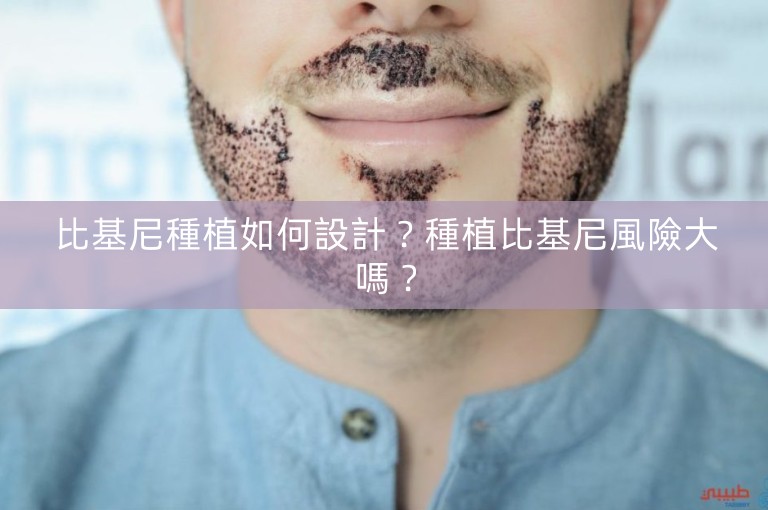 比基尼種植如何設計?種植比基尼風險大嗎? 比基尼種植如何設計?種植比基尼風險大嗎?