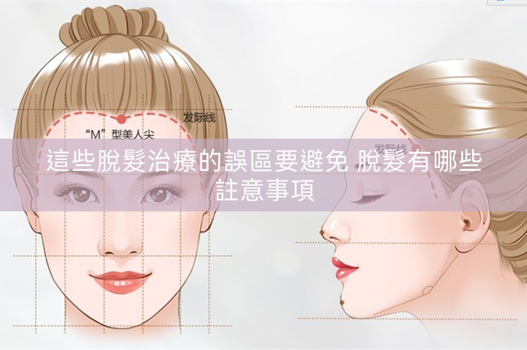 這些脫髮治療的誤區要避免 脫髮有哪些註意事項