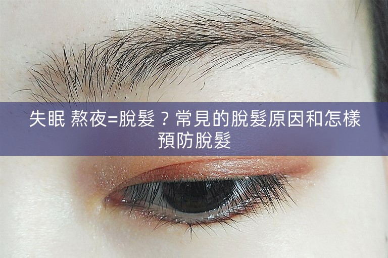 失眠 熬夜=脫髮？常見的脫髮原因和怎樣預防脫髮