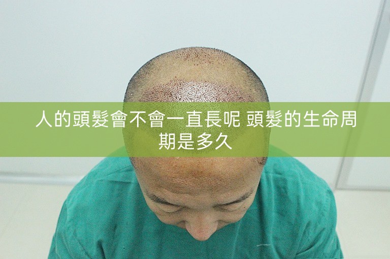 人的頭髮會不會一直長呢 頭髮的生命周期是多久 人的頭髮會不會一直長呢 頭髮的生命周期是多久