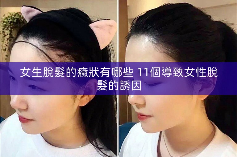 女生脫髮的癥狀有哪些 11個導致女性脫髮的誘因