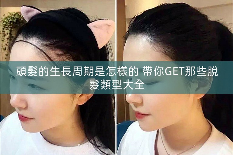 頭髮的生長周期是怎樣的 帶你GET那些脫髮類型大全