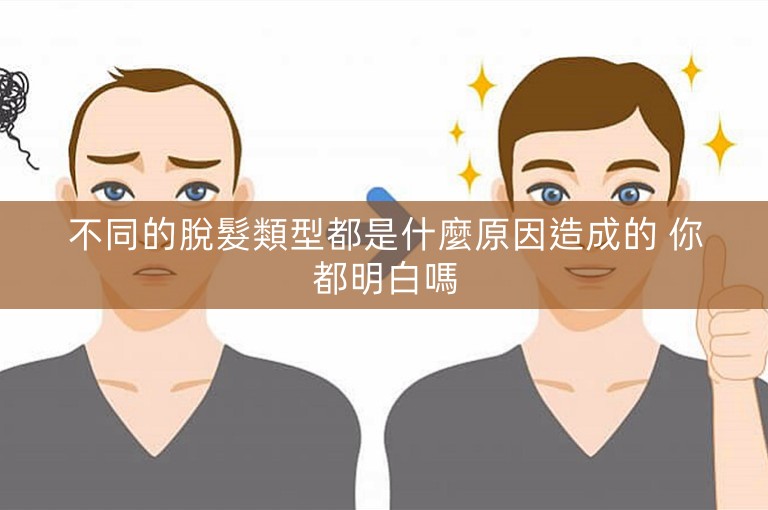 不同的脫髮類型都是什麼原因造成的 你都明白嗎