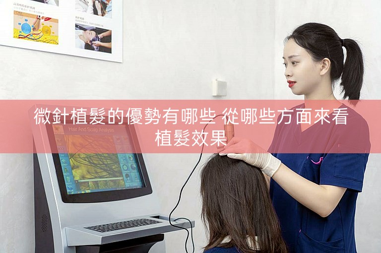 微針植髮的優勢有哪些 從哪些方面來看植髮效果