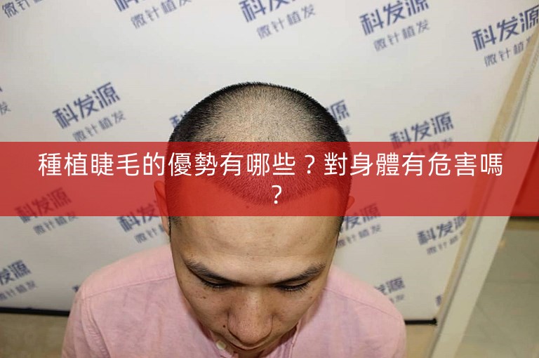 種植睫毛的優勢有哪些？對身體有危害嗎？