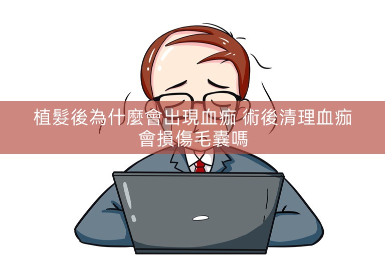 植髮後為什麼會出現血痂 術後清理血痂會損傷毛囊嗎
