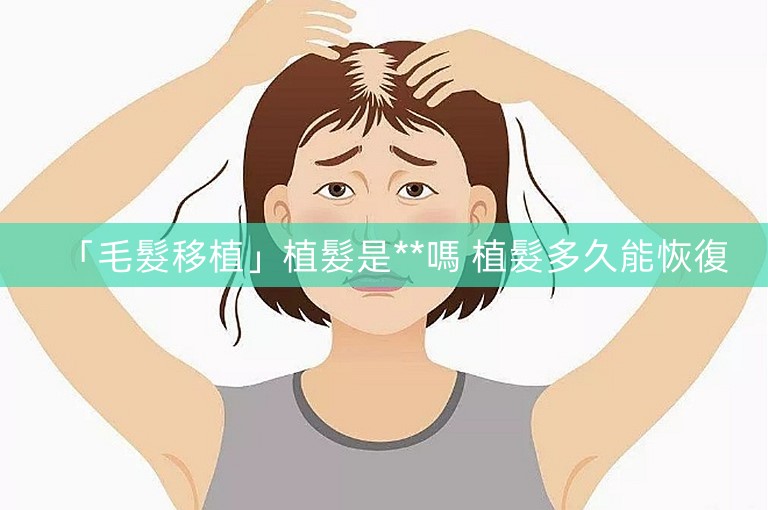 「毛髮移植」植髮是**嗎 植髮多久能恢復