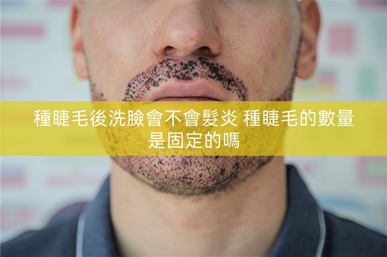 種睫毛後洗臉會不會髮炎 種睫毛的數量是固定的嗎