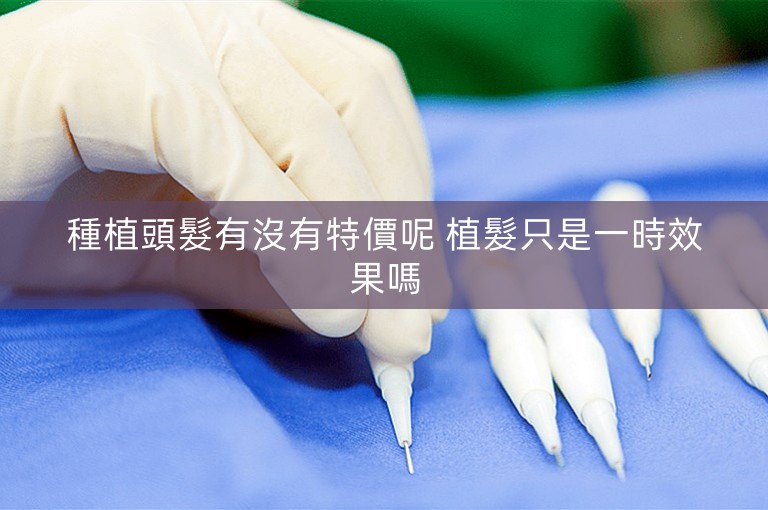 種植頭髮有沒有特價呢 植髮只是一時效果嗎