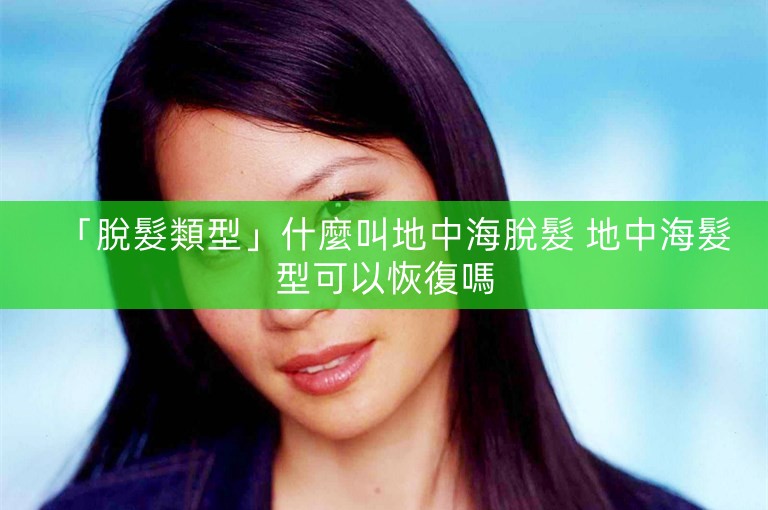 「脫髮類型」什麼叫地中海脫髮 地中海髮型可以恢復嗎