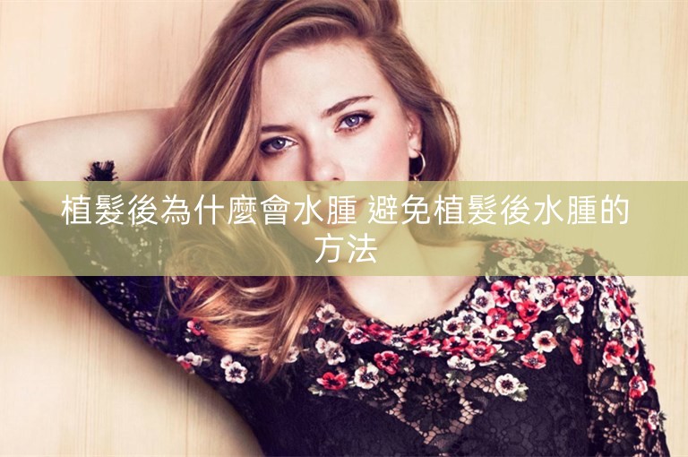 植髮後為什麼會水腫 避免植髮後水腫的方法