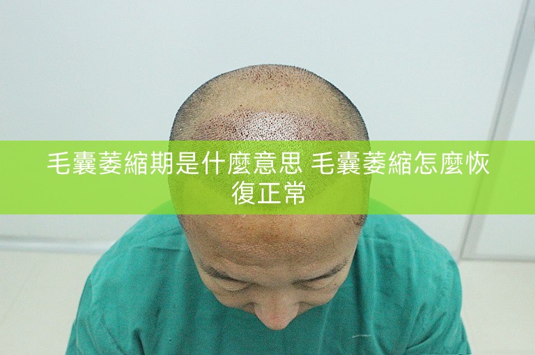 毛囊萎縮期是什麼意思 毛囊萎縮怎麼恢復正常