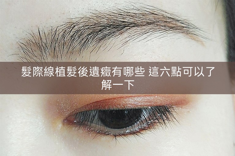 髮際線植髮後遺癥有哪些 這六點可以了解一下