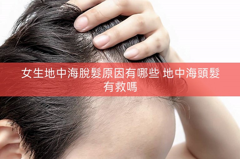 女生地中海脫髮原因有哪些 地中海頭髮有救嗎