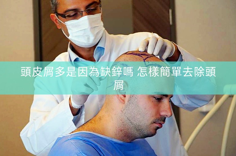 頭皮屑多是因為缺鋅嗎 怎樣簡單去除頭屑