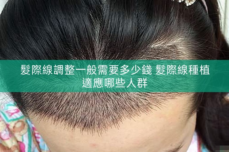 髮際線調整一般需要多少錢 髮際線種植適應哪些人群