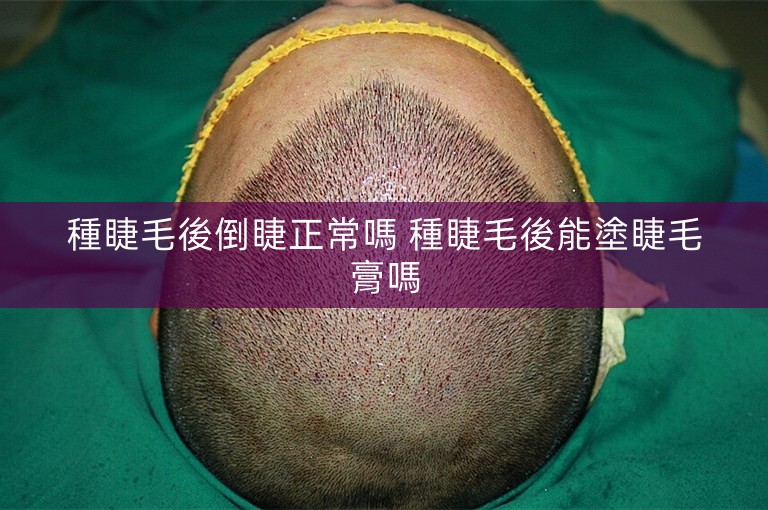 種睫毛後倒睫正常嗎 種睫毛後能塗睫毛膏嗎