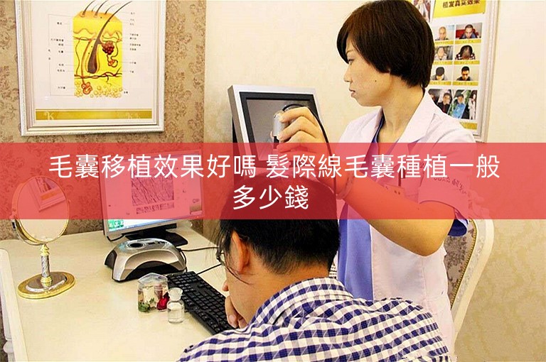 毛囊移植效果好嗎 髮際線毛囊種植一般多少錢 