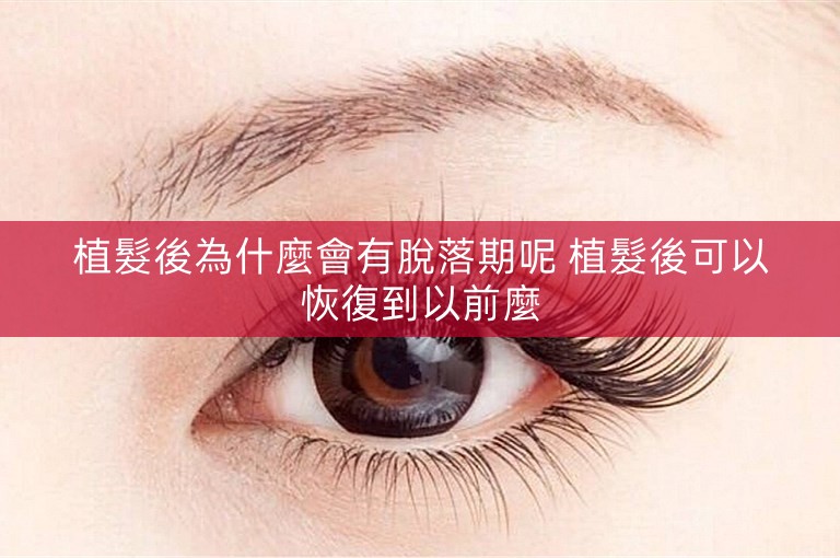 植髮後為什麼會有脫落期呢 植髮後可以恢復到以前麼