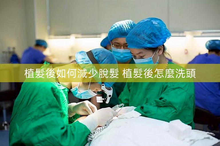 植髮後如何減少脫髮 植髮後怎麼洗頭