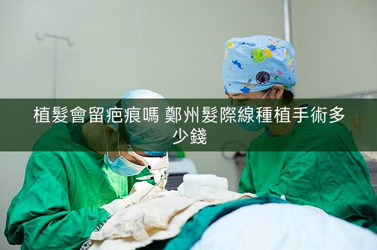 植髮會留疤痕嗎 鄭州髮際線種植手術多少錢