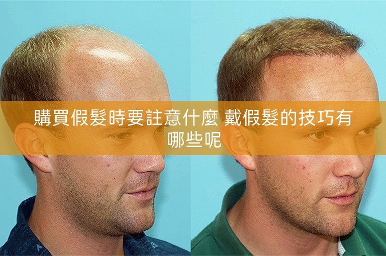 購買假髮時要註意什麼 戴假髮的技巧有哪些呢