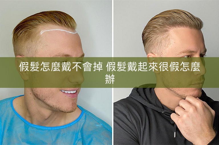 假髮怎麼戴不會掉 假髮戴起來很假怎麼辦