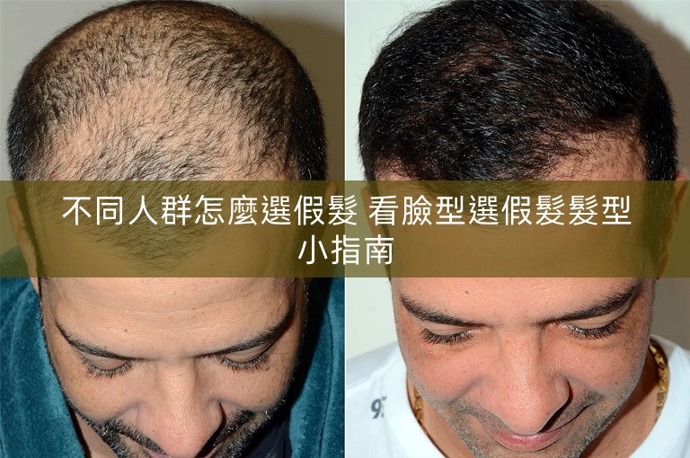 不同人群怎麼選假髮 看臉型選假髮髮型小指南