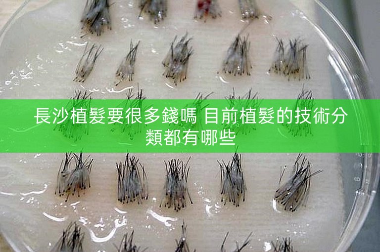 長沙植髮要很多錢嗎 目前植髮的技術分類都有哪些