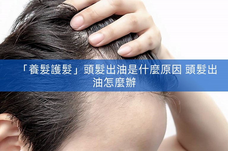 「養髮護髮」頭髮出油是什麼原因 頭髮出油怎麼辦