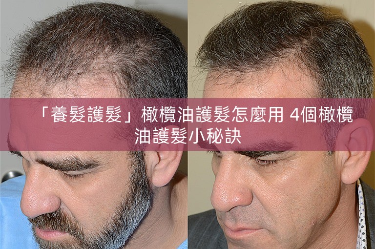「養髮護髮」橄欖油護髮怎麼用 4個橄欖油護髮小秘訣
