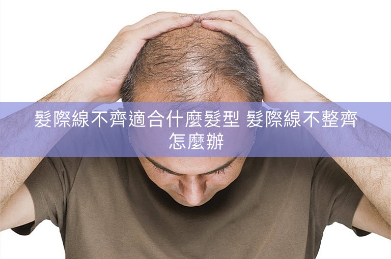 髮際線不齊適合什麼髮型 髮際線不整齊怎麼辦