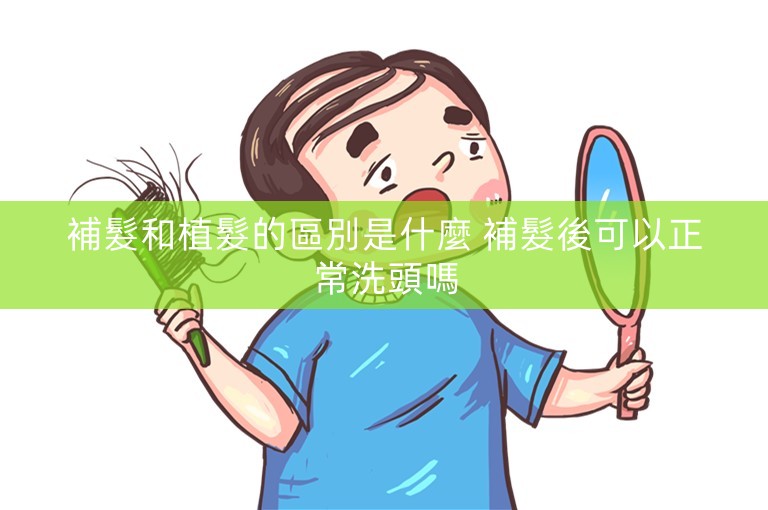 補髮和植髮的區別是什麼 補髮後可以正常洗頭嗎