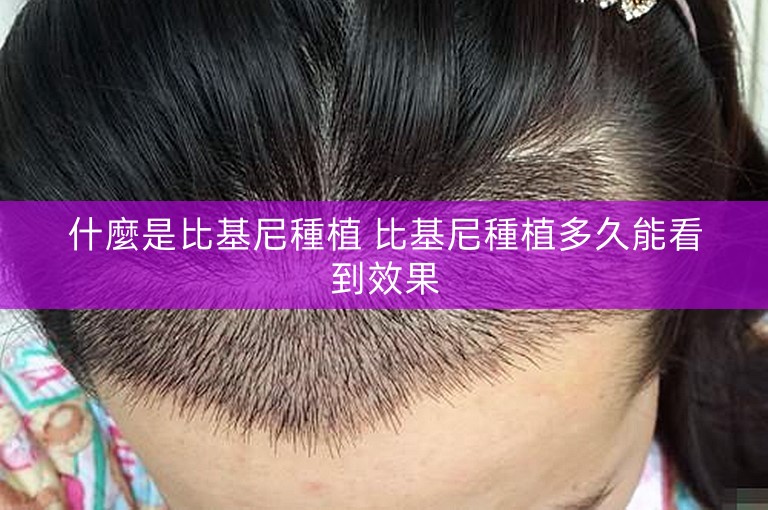 什麼是比基尼種植 比基尼種植多久能看到效果