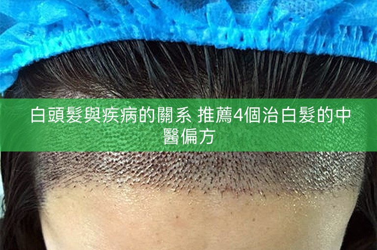 白頭髮與疾病的關系 推薦4個治白髮的中醫偏方