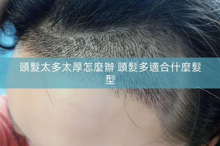 頭髮太多太厚怎麼辦 頭髮多適合什麼髮型 頭髮太多太厚怎麼辦 頭髮多適合什麼髮型