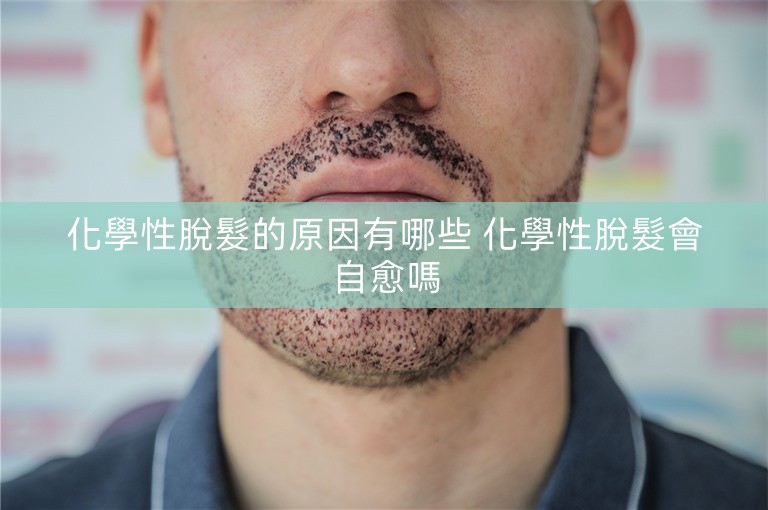 化學性脫髮的原因有哪些 化學性脫髮會自愈嗎 化學性脫髮的原因有哪些 化學性脫髮會自愈嗎