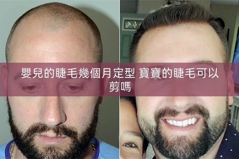 嬰兒的睫毛幾個月定型 寶寶的睫毛可以剪嗎