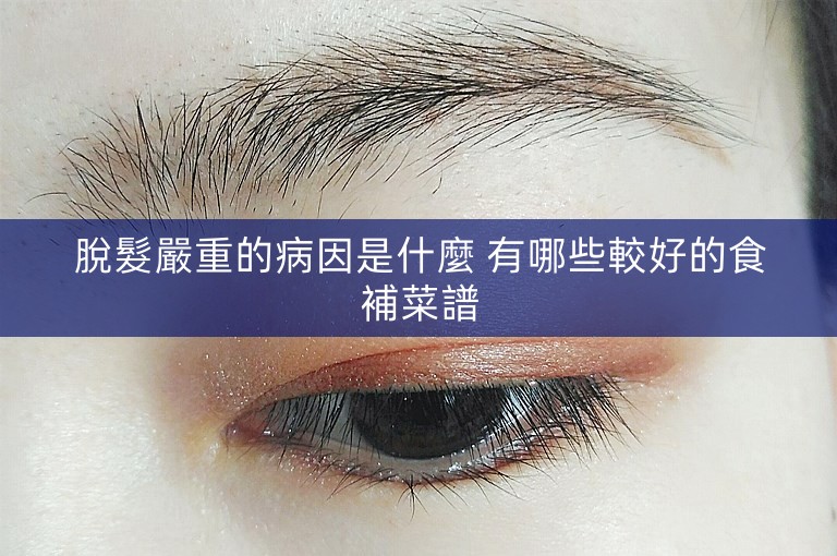 脫髮嚴重的病因是什麼 有哪些較好的食補菜譜