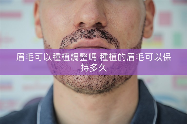 眉毛可以種植調整嗎 種植的眉毛可以保持多久