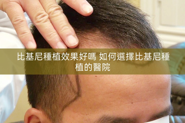 比基尼種植效果好嗎 如何選擇比基尼種植的醫院 比基尼種植效果好嗎 如何選擇比基尼種植的醫院