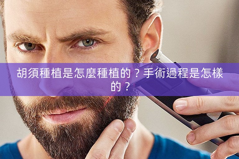 胡須種植是怎麼種植的？手術過程是怎樣的？