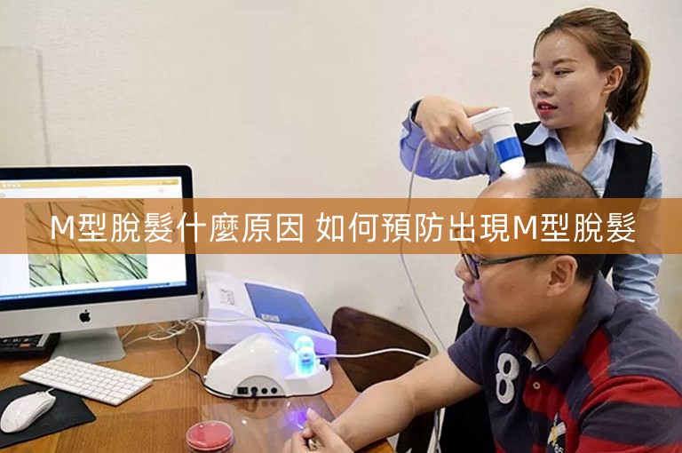 M型脫髮什麼原因 如何預防出現M型脫髮