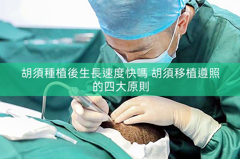 胡須種植後生長速度快嗎 胡須移植遵照的四大原則